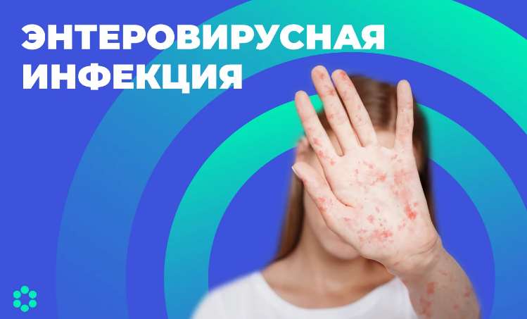 Энтеровирусные инфекции