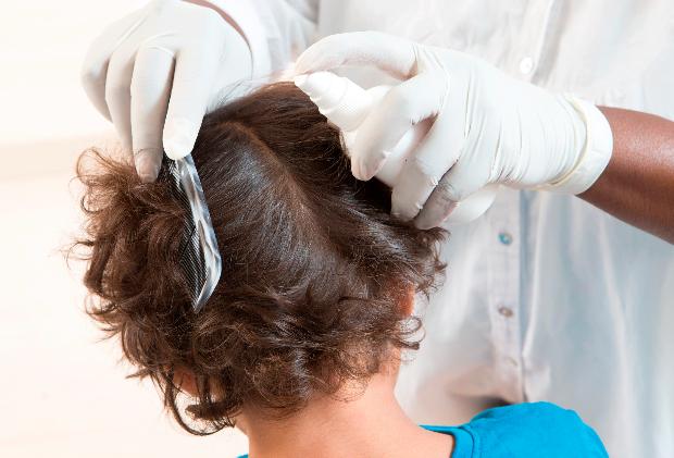 Педикулез! Что это такое и как его избежать.
