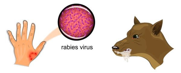 Профилактика бешенства   